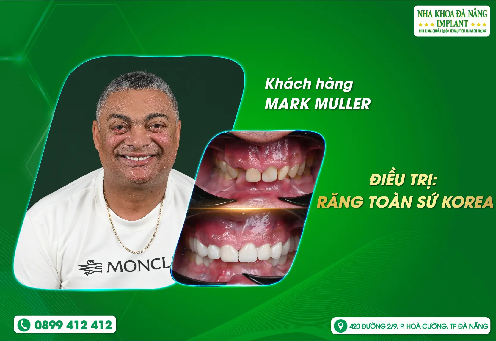 Một nụ cười chuẩn mực giúp bạn tự tin hơn mỗi ngày