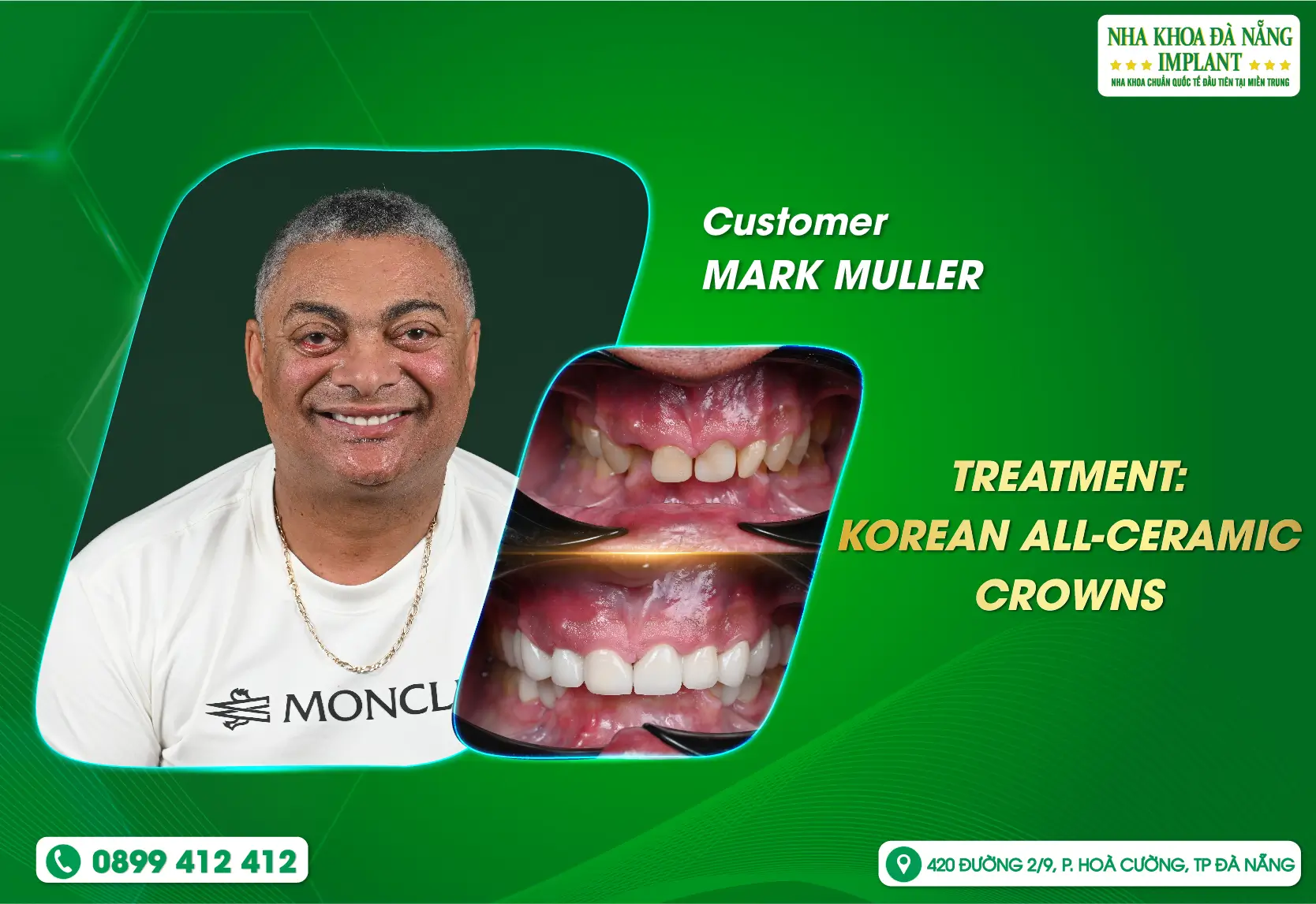 A well-balanced smile helps you feel more confident every day.