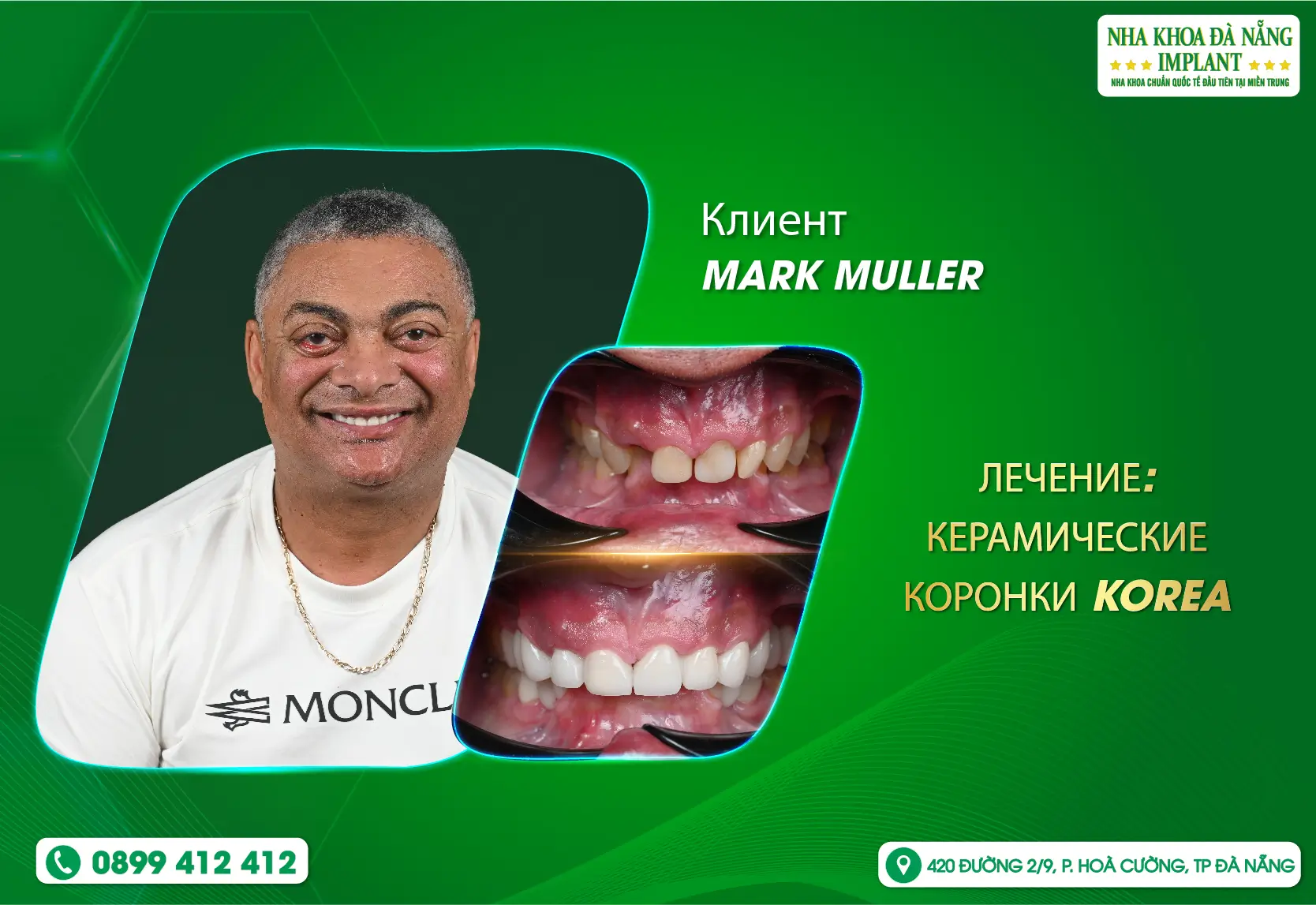 Гармоничная улыбка помогает чувствовать уверенность каждый день.