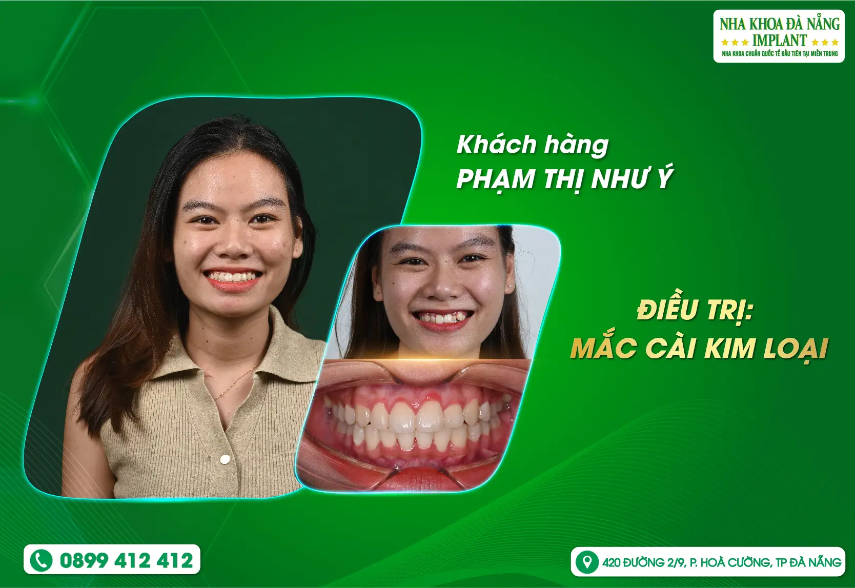 Nụ cười đẹp bắt đầu từ những thay đổi nhỏ mỗi ngày