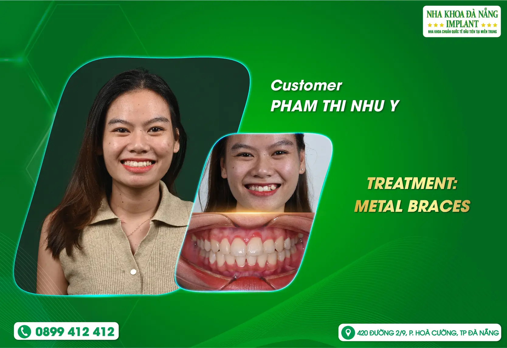 A beautiful smile begins with small changes every day.