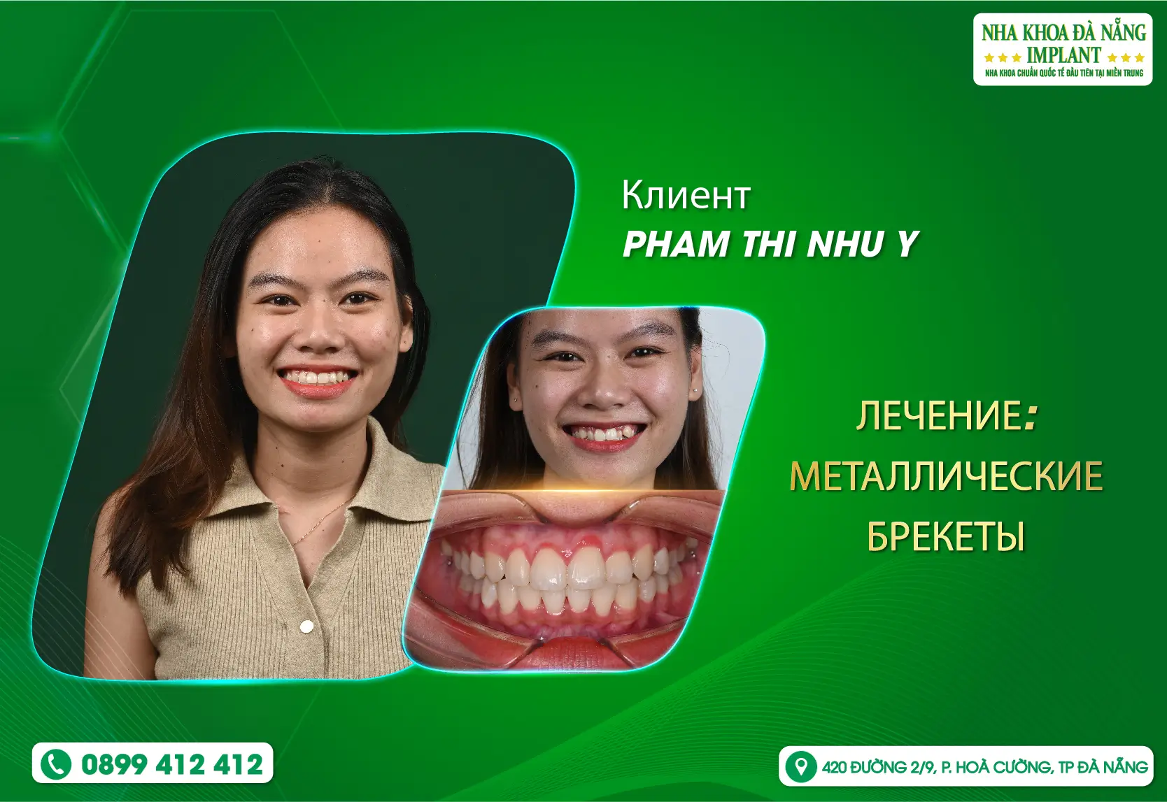 Красивая улыбка начинается с небольших изменений каждый день.