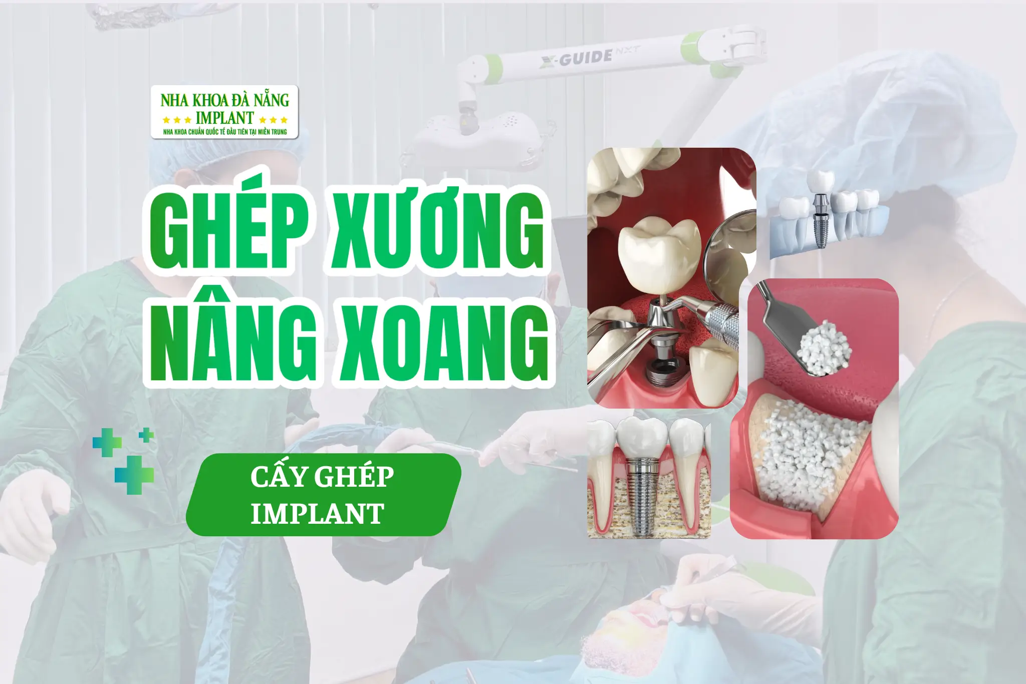 Ghép Xương – Nâng Xoang Trong Implant: Khi Nào CẦN, Khi Nào KHÔNG?