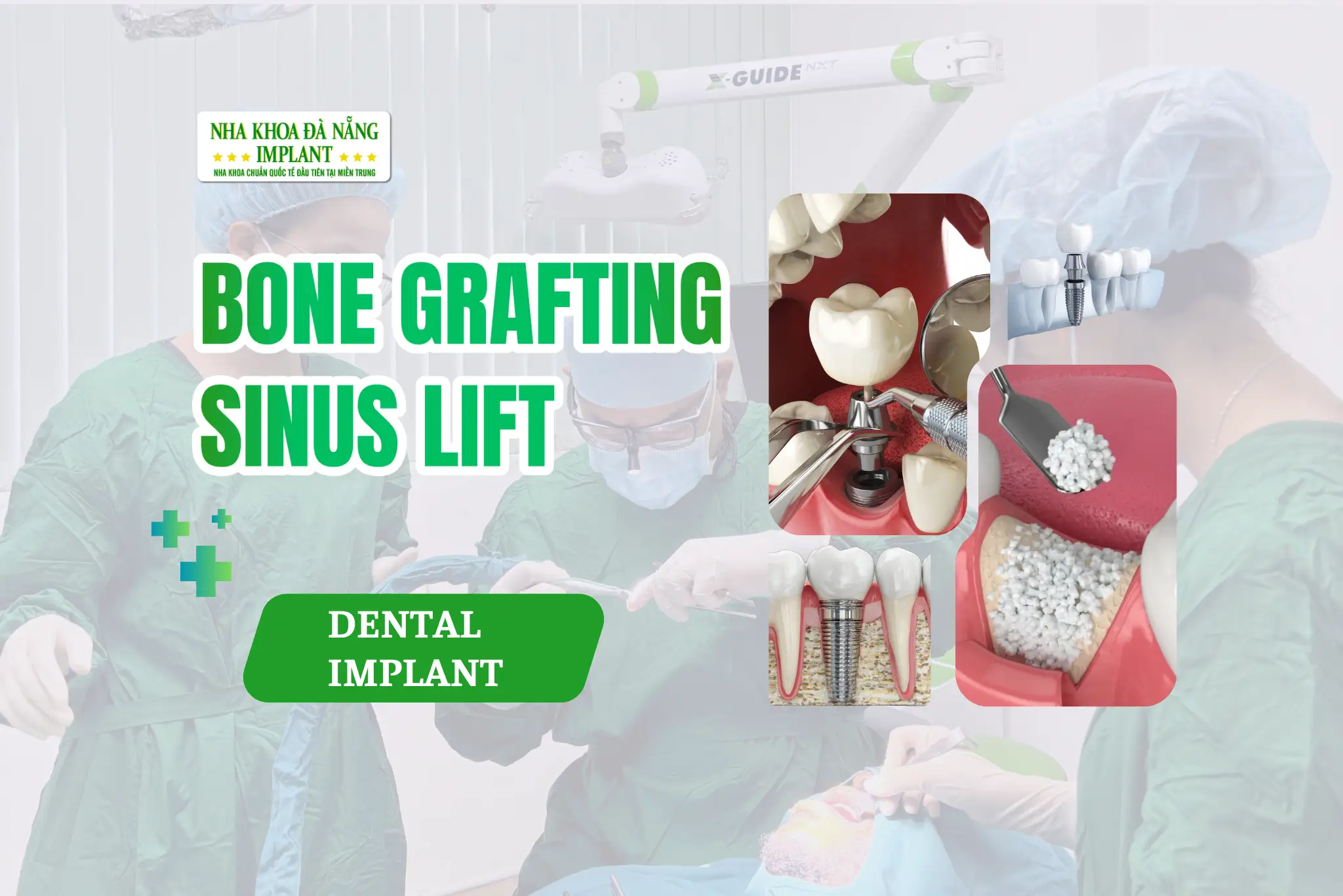 Bone Grafting – Sinus Lift in Dental Implants: When Is It NECESSARY, and When Is It NOT?