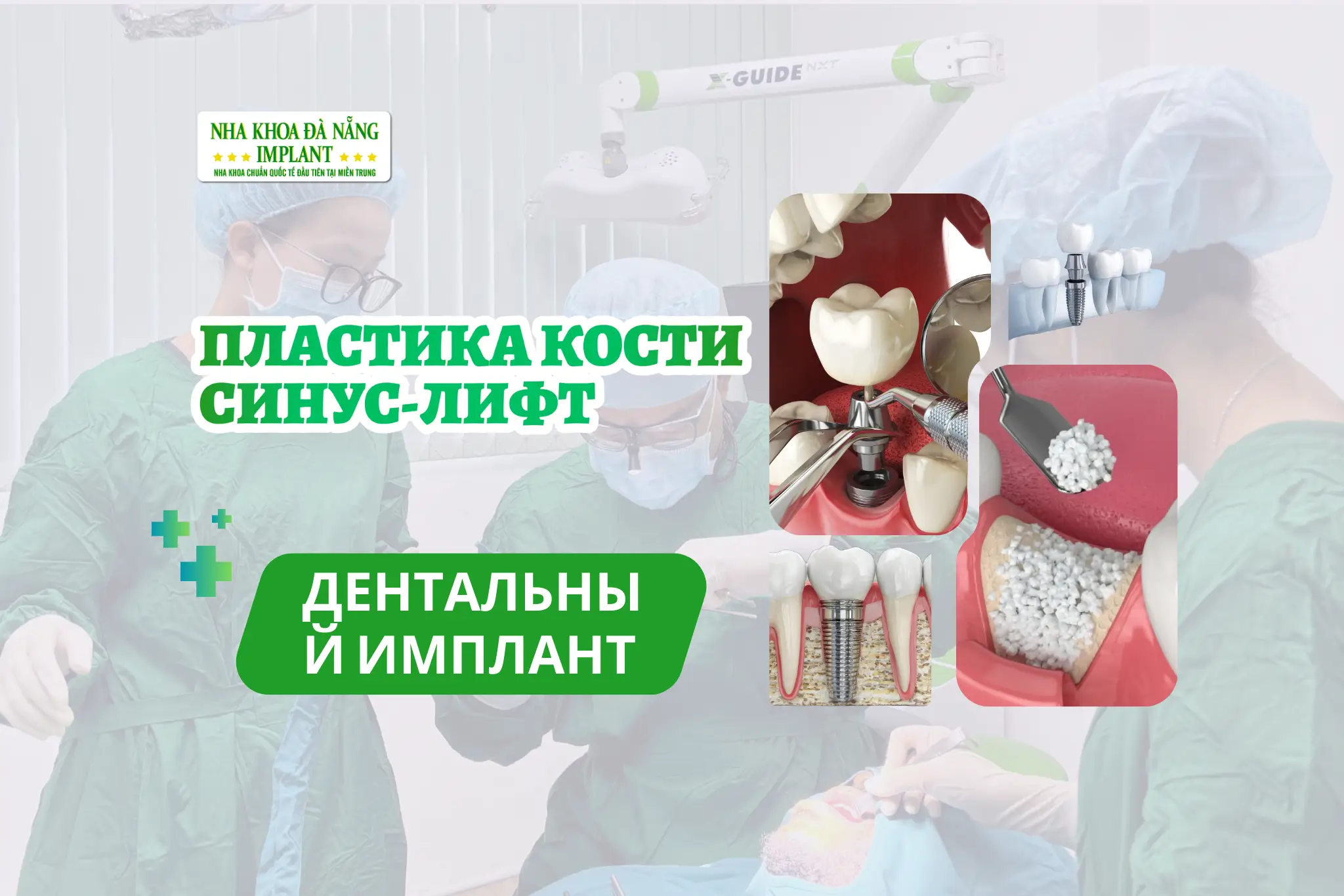 Костная пластика и синус-лифтинг при дентальной имплантации: когда НУЖНО, а когда НЕТ?