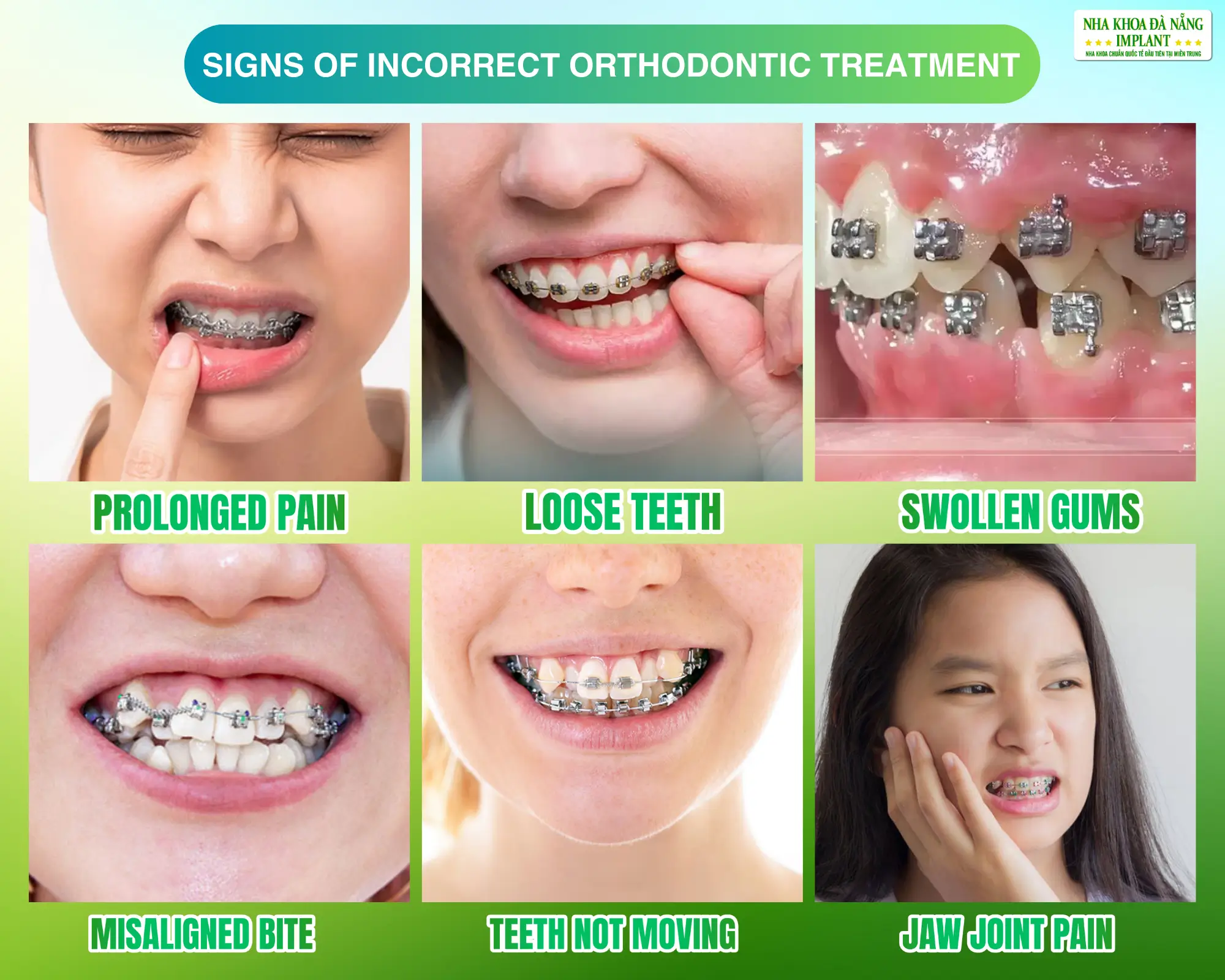 Early Signs of Incorrect Orthodontic Treatment You Should Recognize