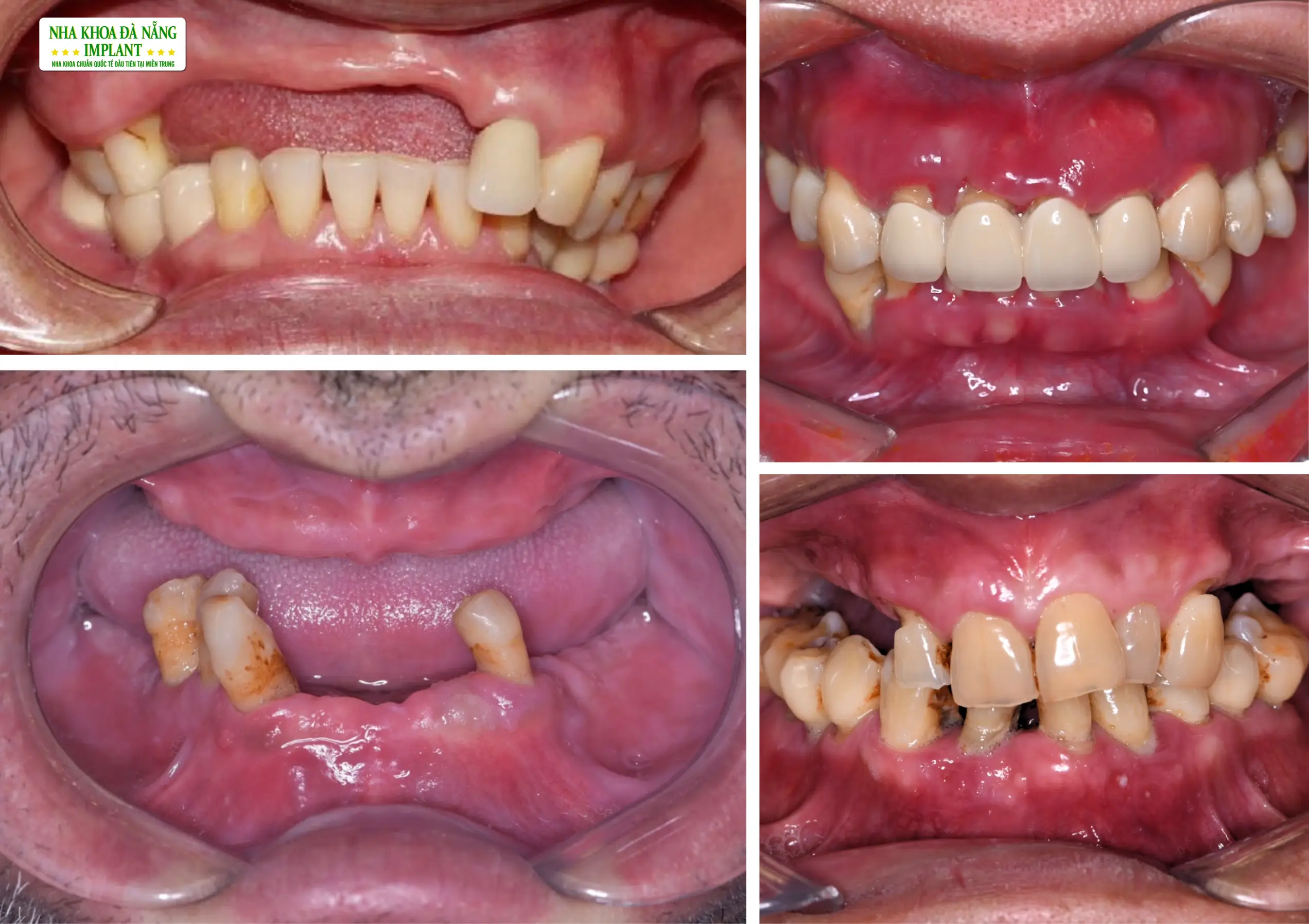 Случаи, требующие дополнительного времени