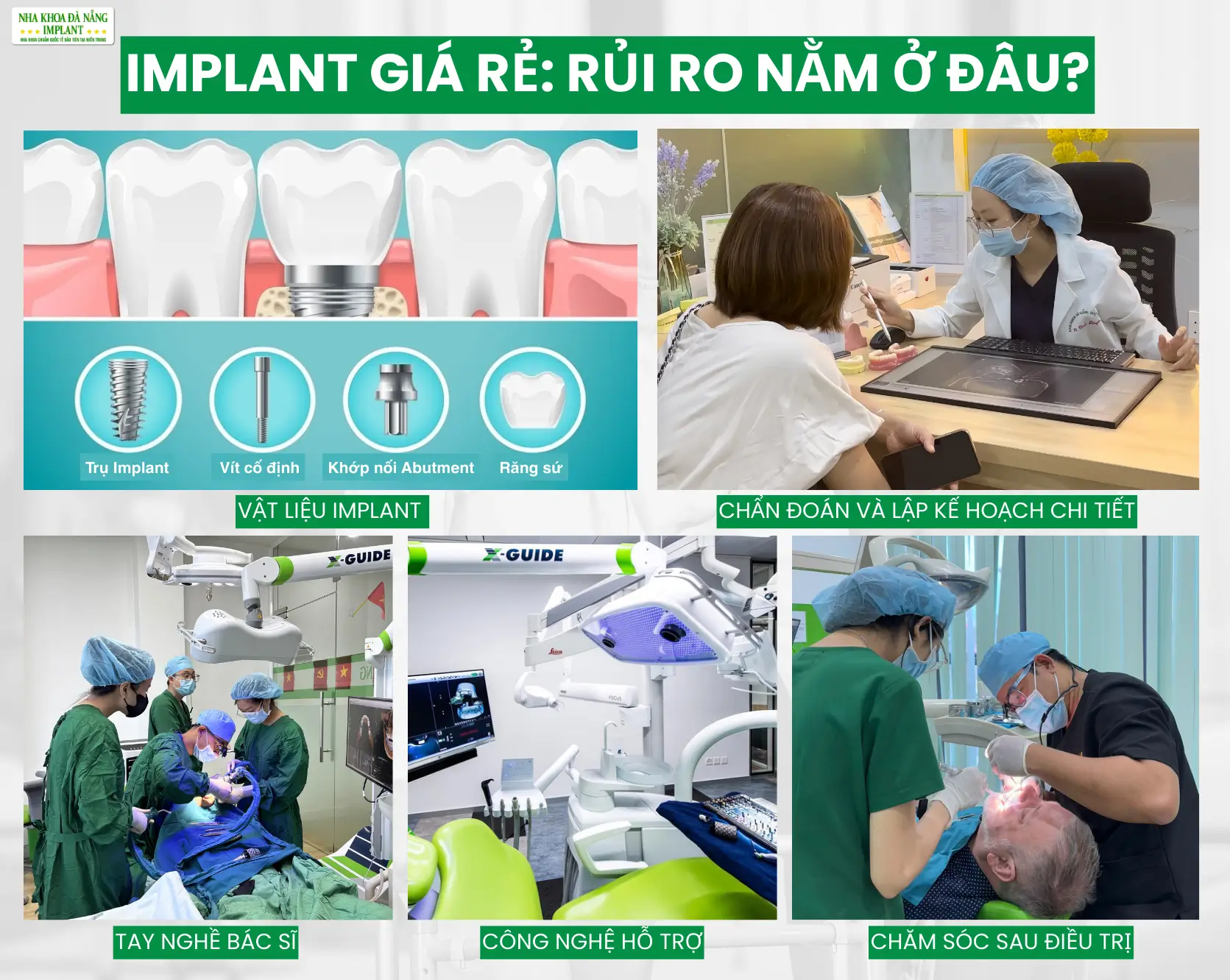 Vậy Implant giá rẻ nguy hiểm ở điểm nào?