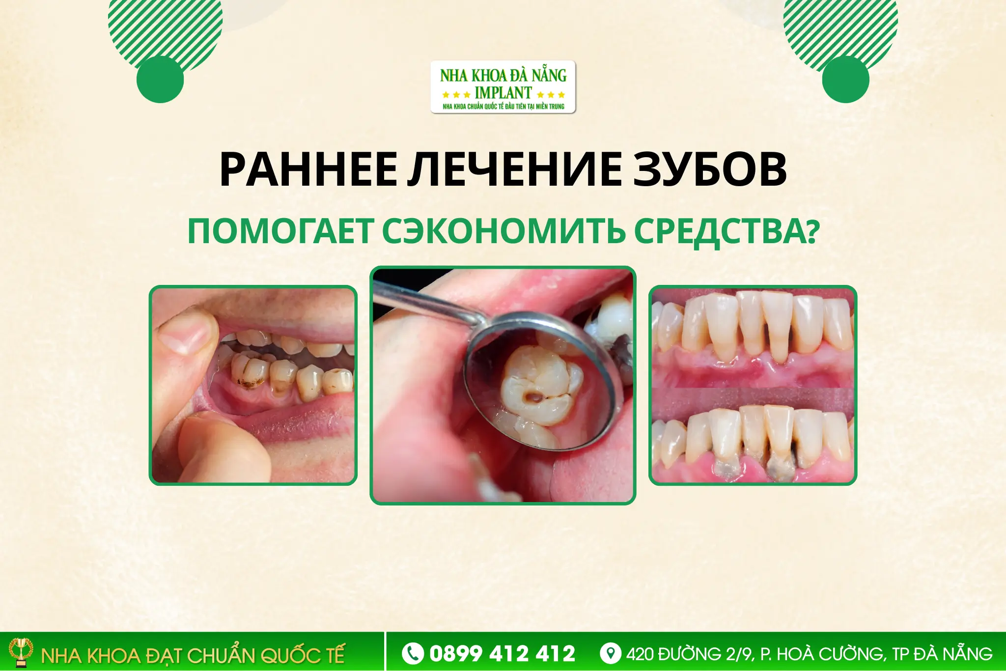 Почему раннее лечение заболеваний полости рта помогает сэкономить средства?