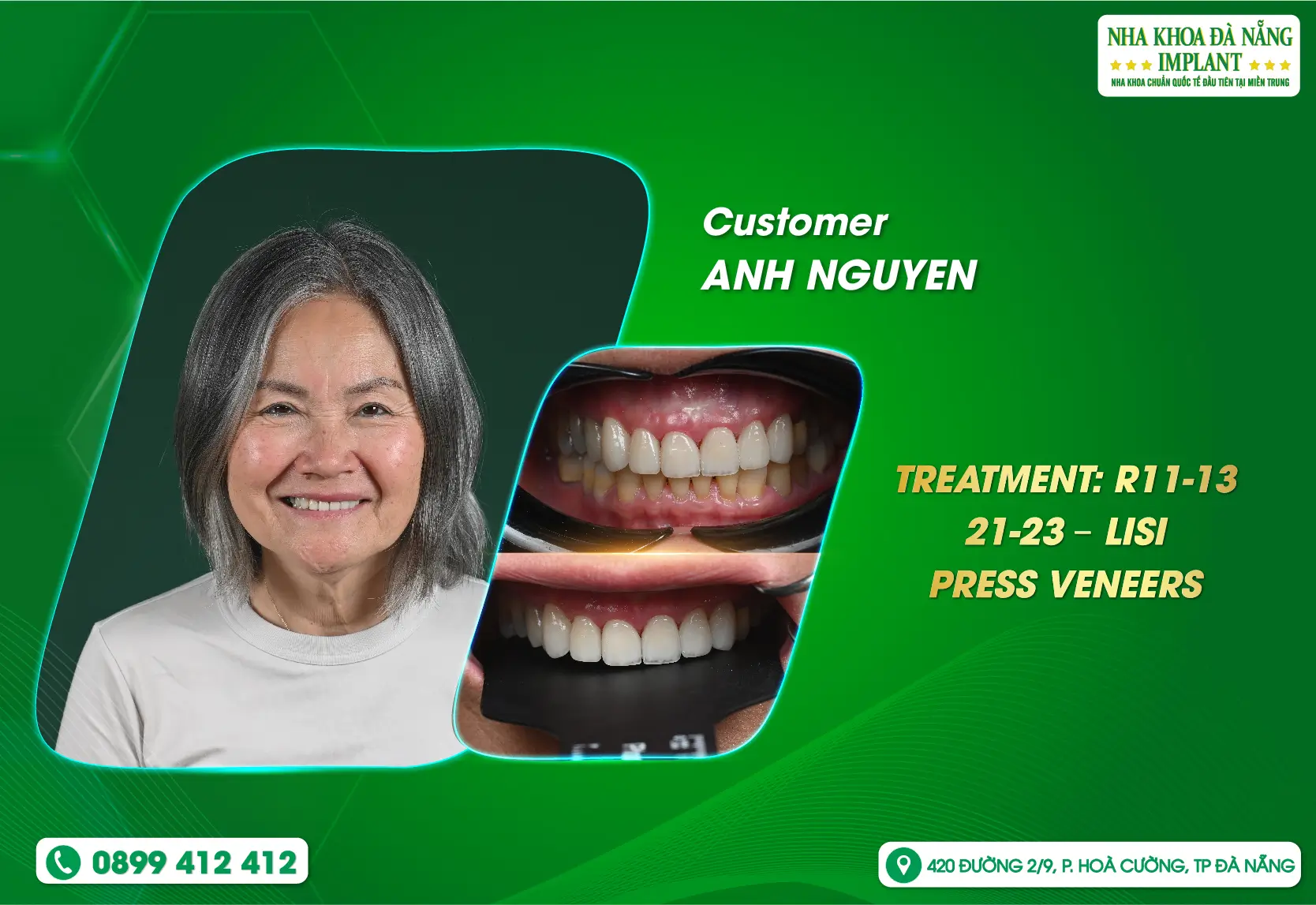 When trust begins with genuine reviews.