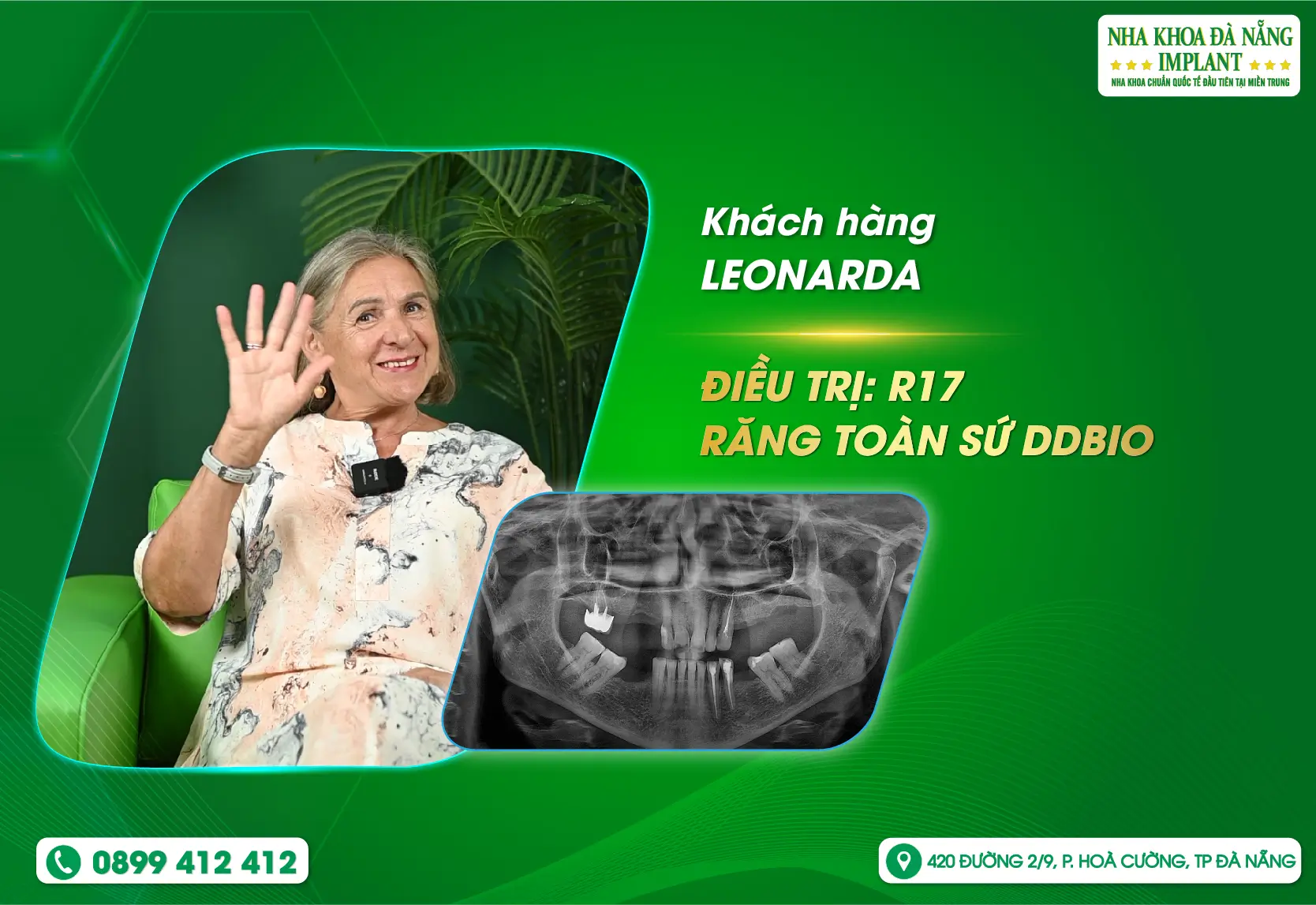“Tôi chưa từng có những trải nghiệm nào tốt như vậy” - Chia sẻ từ khách hàng LEONARDA