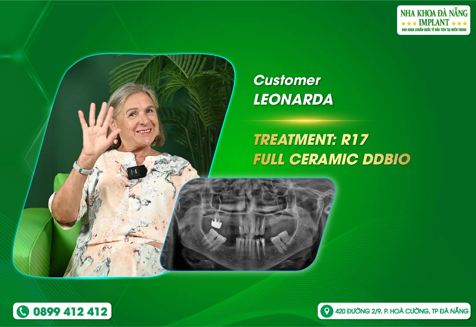 “I’ve never had such a good experience before” – Shared by customer LEONARDA.