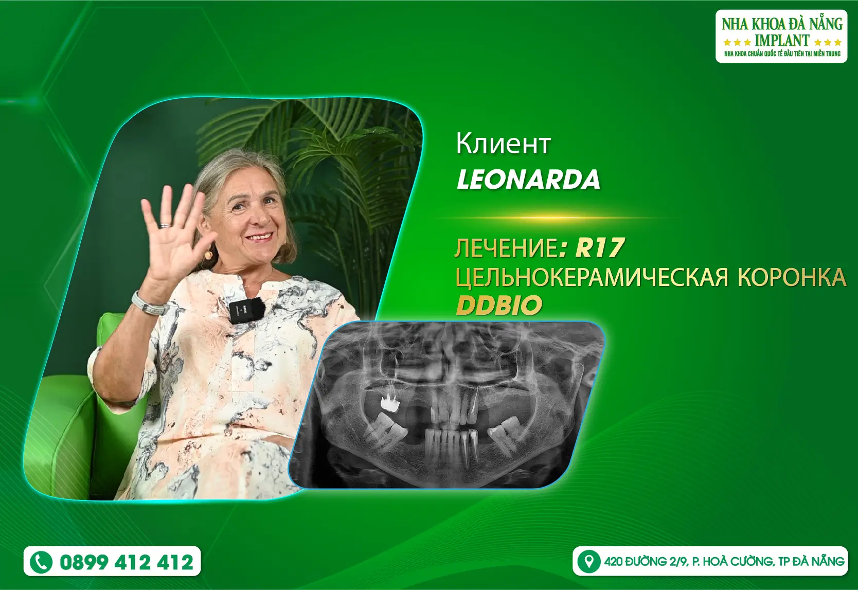 «У меня никогда не было такого хорошего опыта» — отзыв клиента LEONARDA.