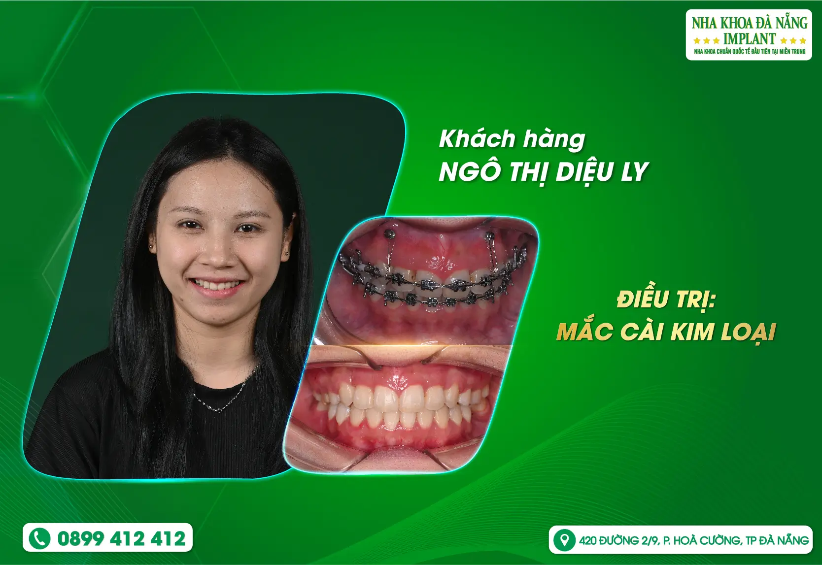 Một hành trình thay đổi nhỏ mỗi ngày, để đổi lại một nụ cười tự tin lâu dài
