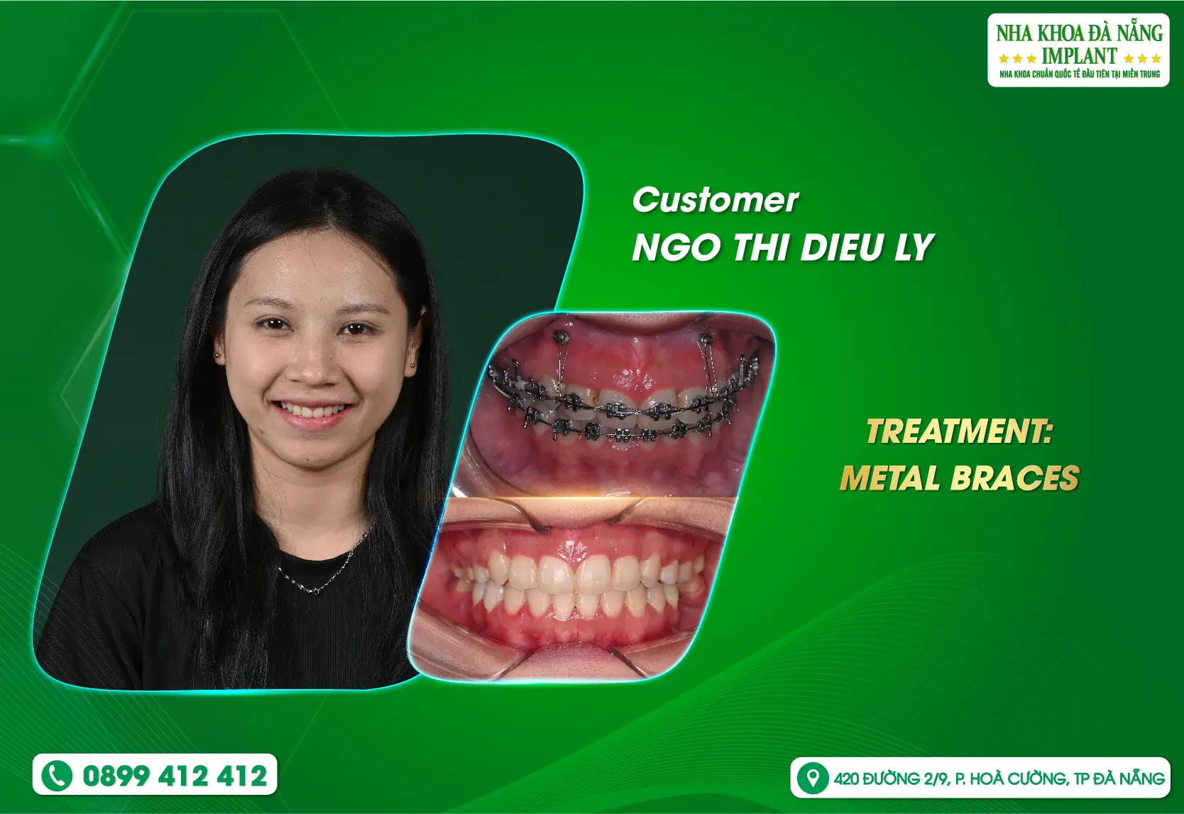 A journey of small changes each day, leading to a confident smile for the long term.