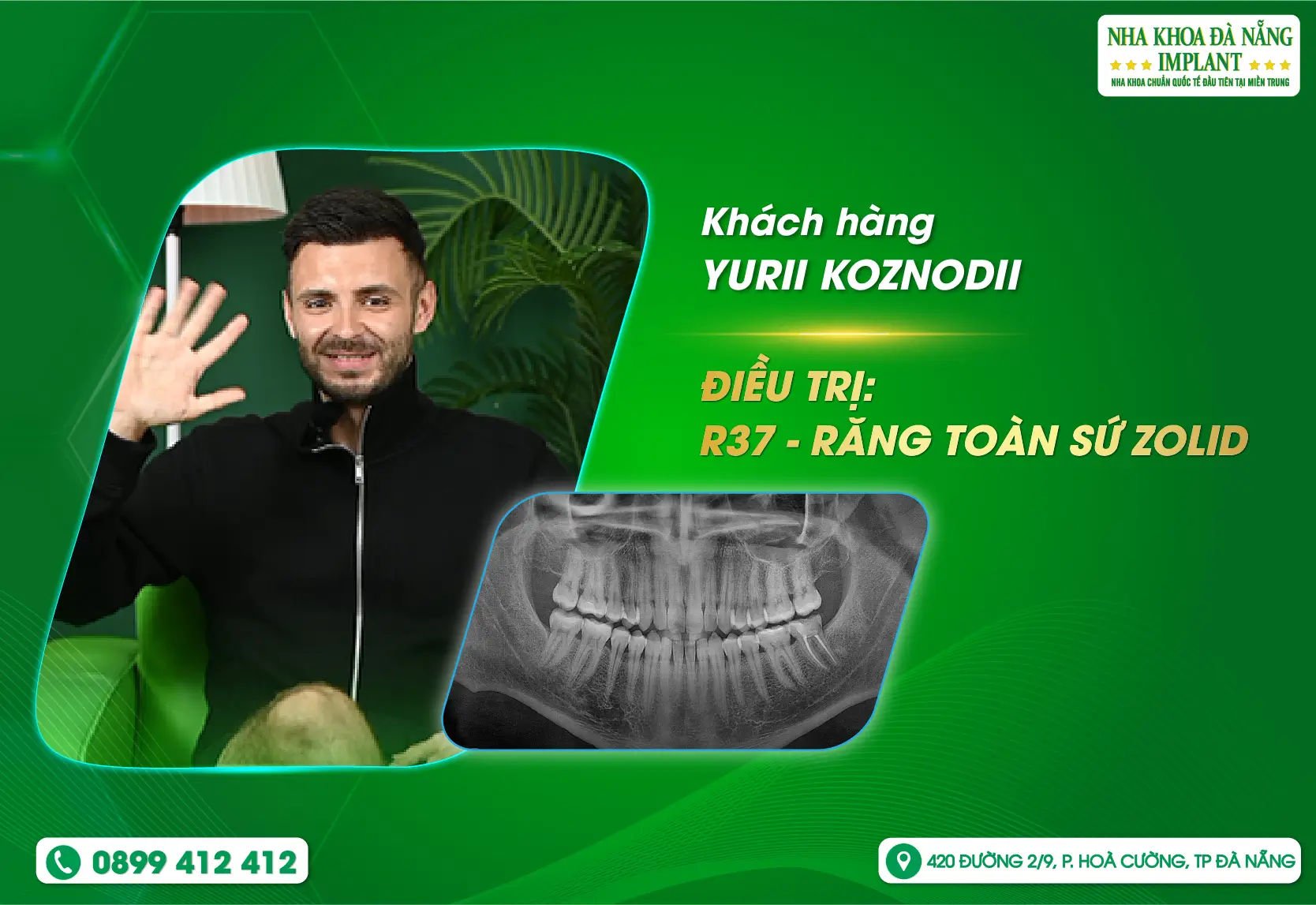 Du khách Nga giữa hàng loạt lựa chọn – Vì sao lại chọn Nha Khoa Đà Nẵng Implant?