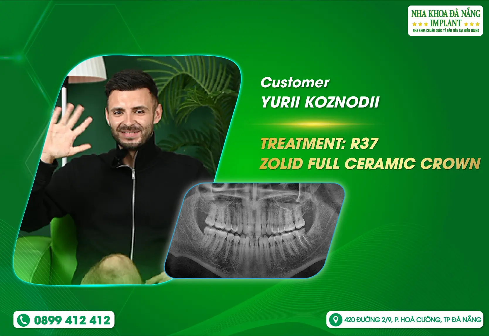 Among many choices, why do Russian tourists choose Da Nang Implant Dental Clinic?