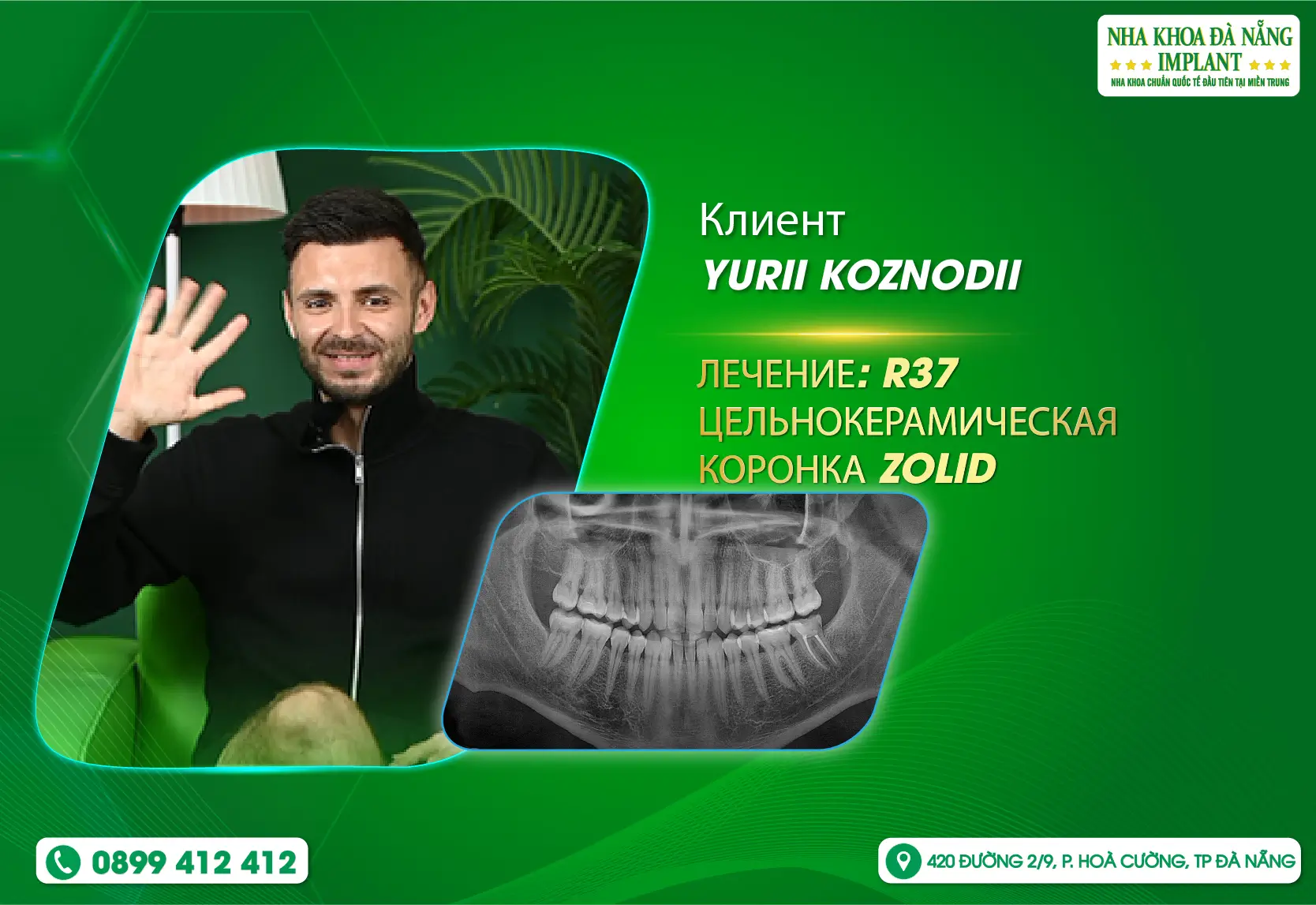 Почему российские туристы выбирают Da Nang Implant Dental Clinic?