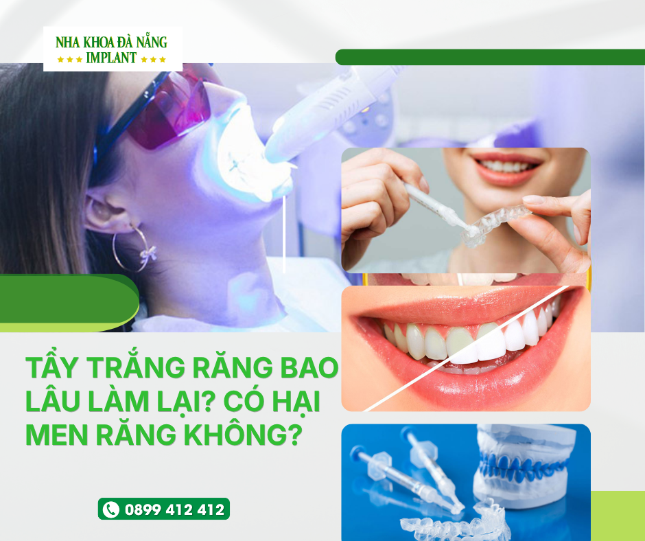 TẨY TRẮNG RĂNG BAO LÂU LÀM LẠI? TẨY TRẮNG CÓ HẠI MEN RĂNG KHÔNG?