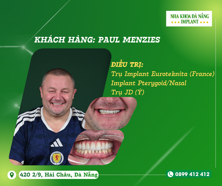 Khách hàng: Paul Menzies