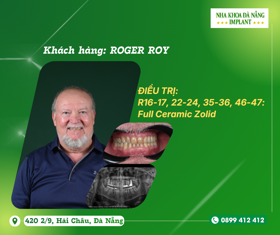 Khách hàng: ROGER ROY