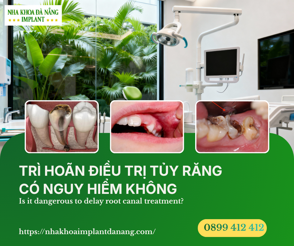 TRÌ HOÃN ĐIỀU TRỊ TỦY RĂNG - 6 Hậu quả bạn không nên xem nhẹ