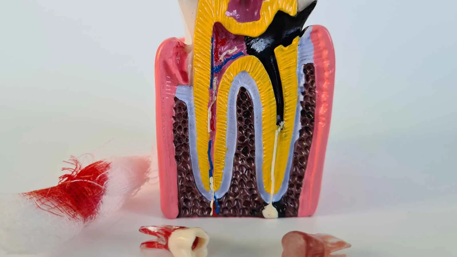 Trì hoãn điều trị tủy răng