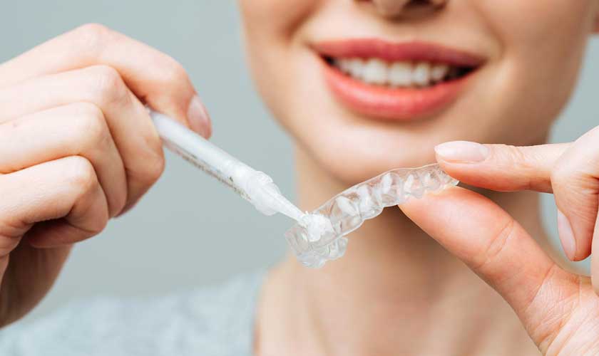 Tuân thủ hướng dẫn của bác sĩ nha khoa