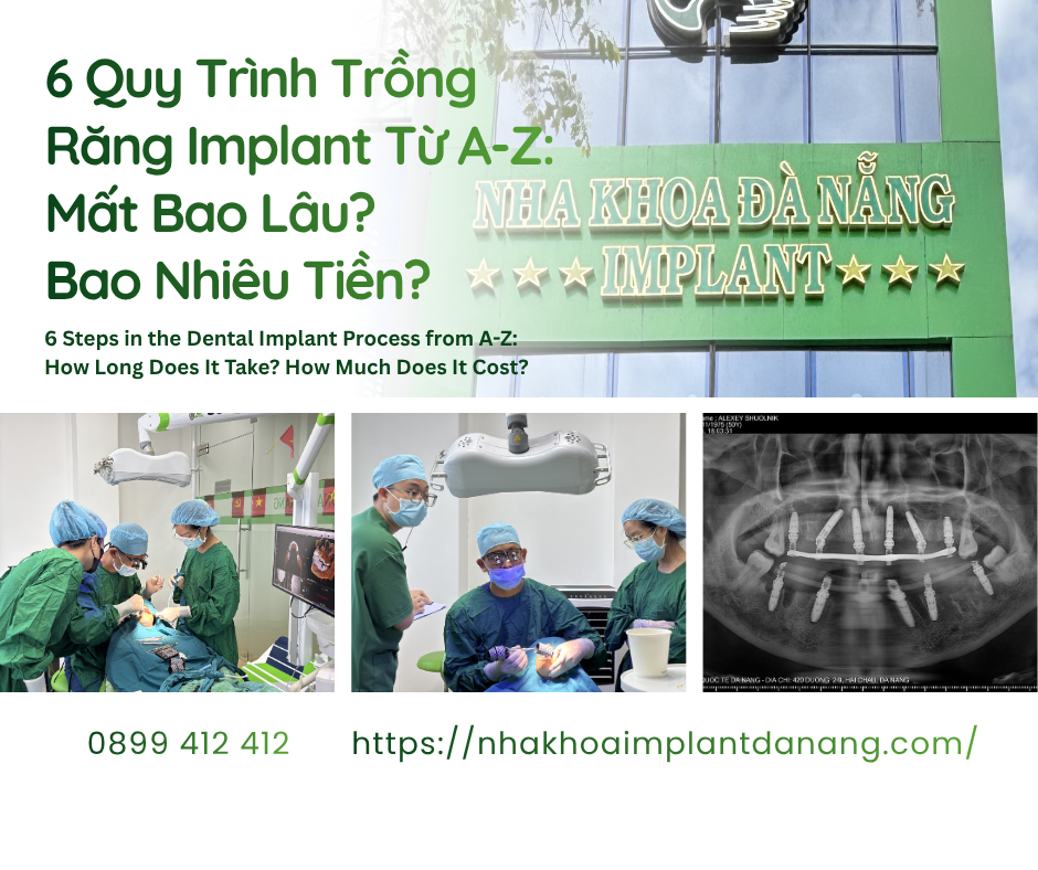 6-Step Dental Implant Procedure From A–Z: How Long Does It Take? How Much Does It Cost?