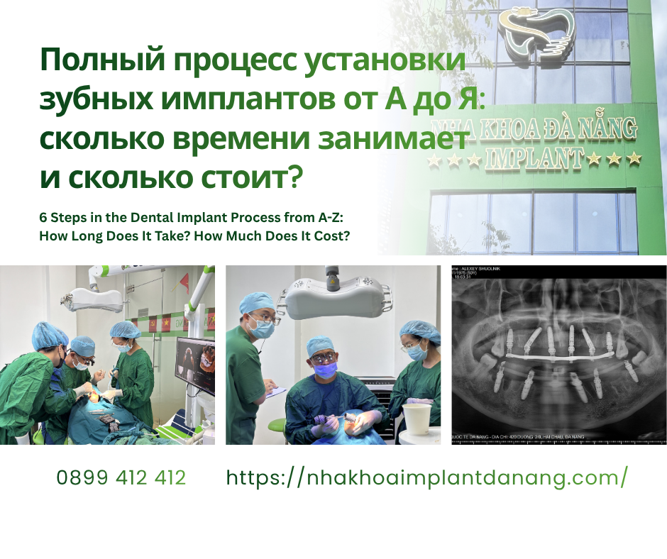 Полный процесс установки зубных имплантов от А до Я: сколько времени занимает и сколько стоит?