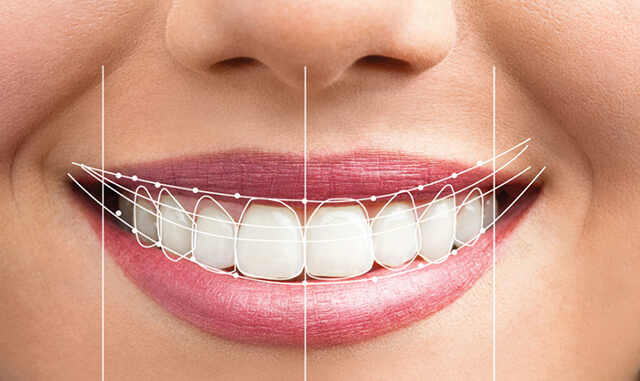 Đảm bảo nụ cười thẩm mỹ sau phục hình