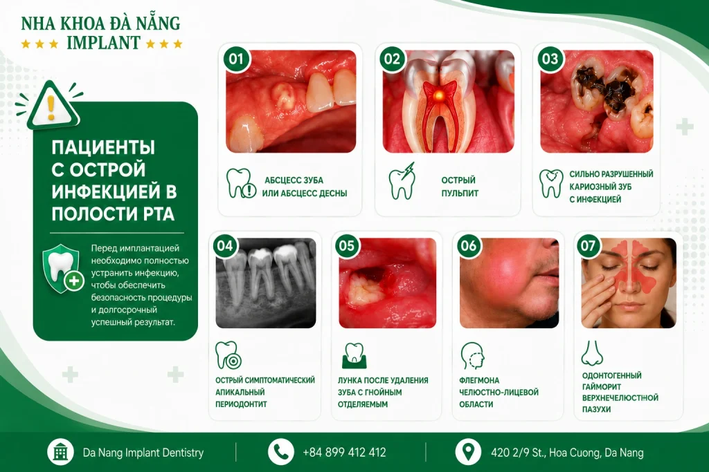 Некоторые инфекции необходимо вылечить перед установкой имплантата.
