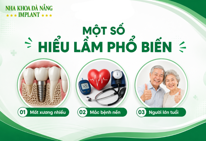 8 Trường Hợp Không Nên Cấy Implant Ngay – Bác Sĩ Ít Khi Nói Rõ 10 Một số hiểu lầm phổ biến về chống chỉ định implant