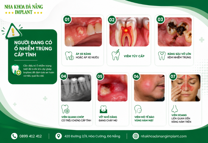 8 Trường Hợp Không Nên Cấy Implant Ngay – Bác Sĩ Ít Khi Nói Rõ 8 Một số nhiễm trùng cần được điều trị trước khi cấy Implant