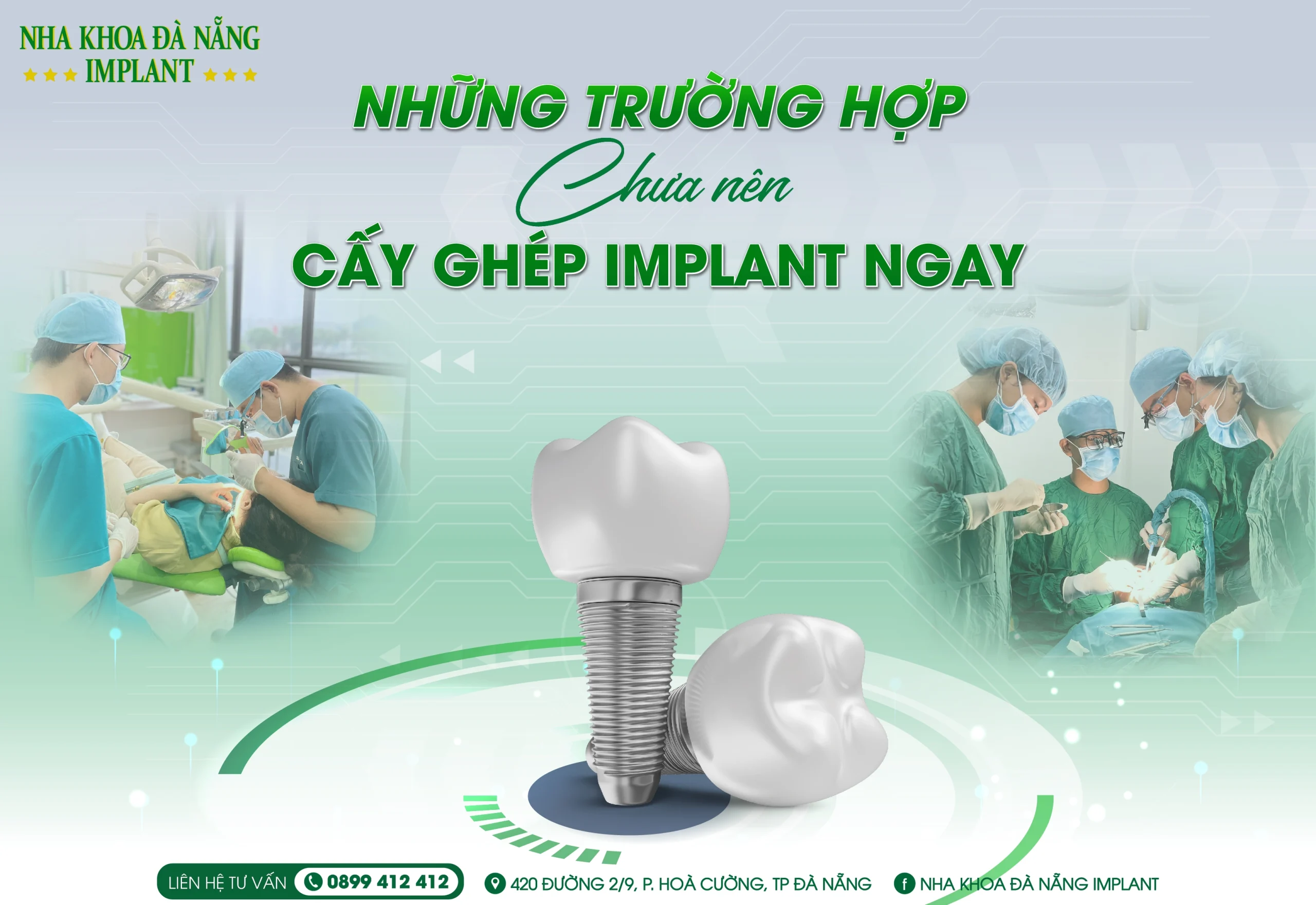 8 Trường Hợp Không Nên Cấy Implant Ngay – Bác Sĩ Ít Khi Nói Rõ
