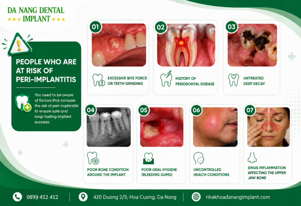 People Who Are At Risk Of Peri Implantitis