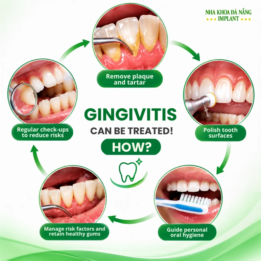 What Complications Can Early Gingivitis Treatment Help Prevent? 9 How is gingivitis treated?