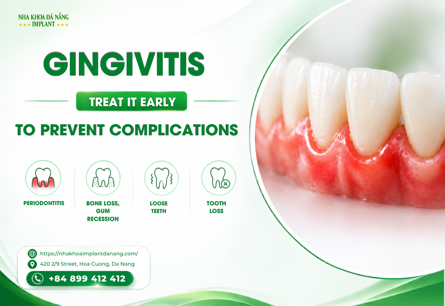 What Complications Can Early Gingivitis Treatment Help Prevent?