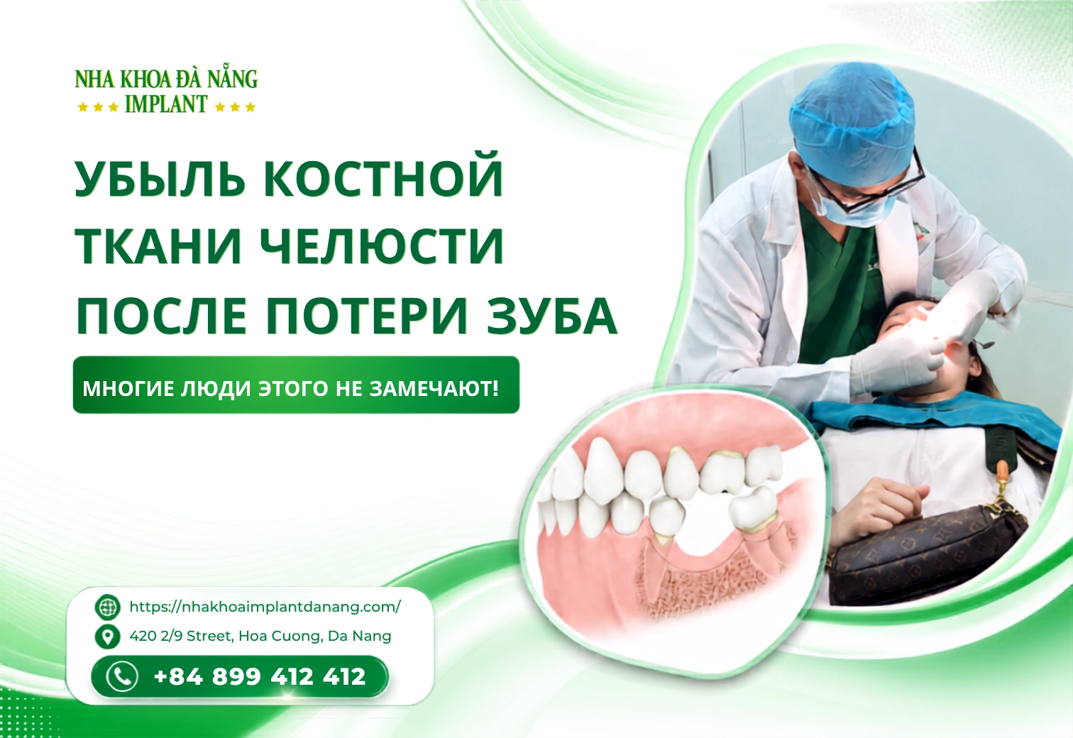 Резорбция костной ткани челюсти после потери зуба: многие этого не замечают