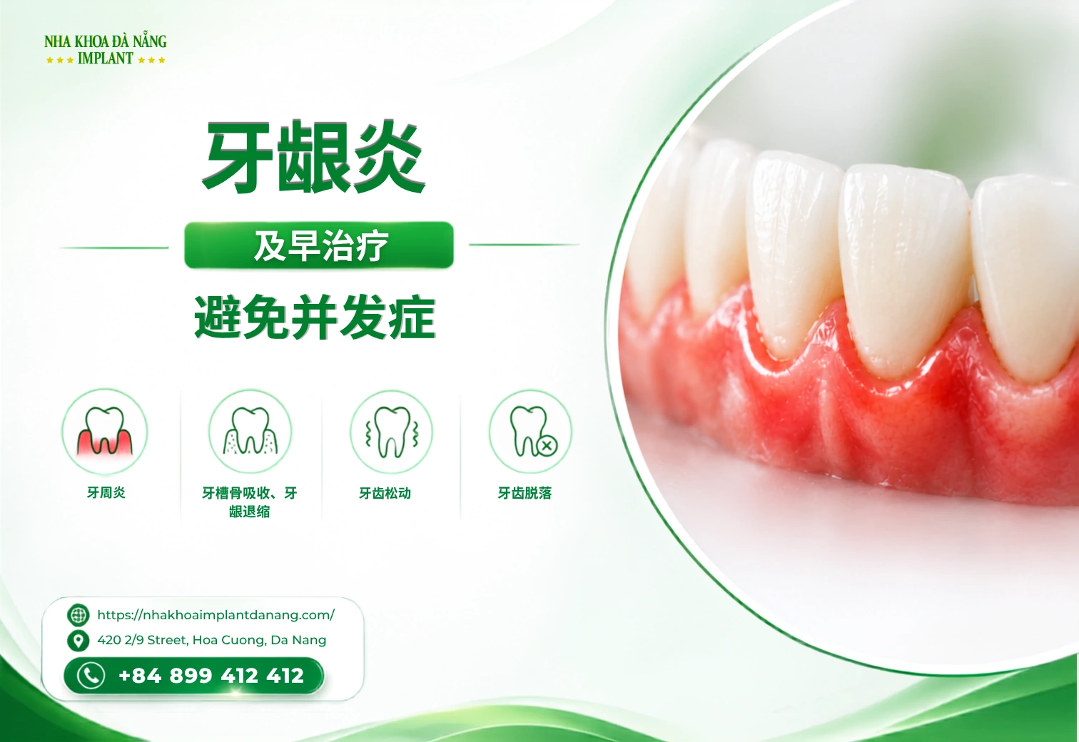 早期治疗牙龈炎有助于预防哪些并发症？