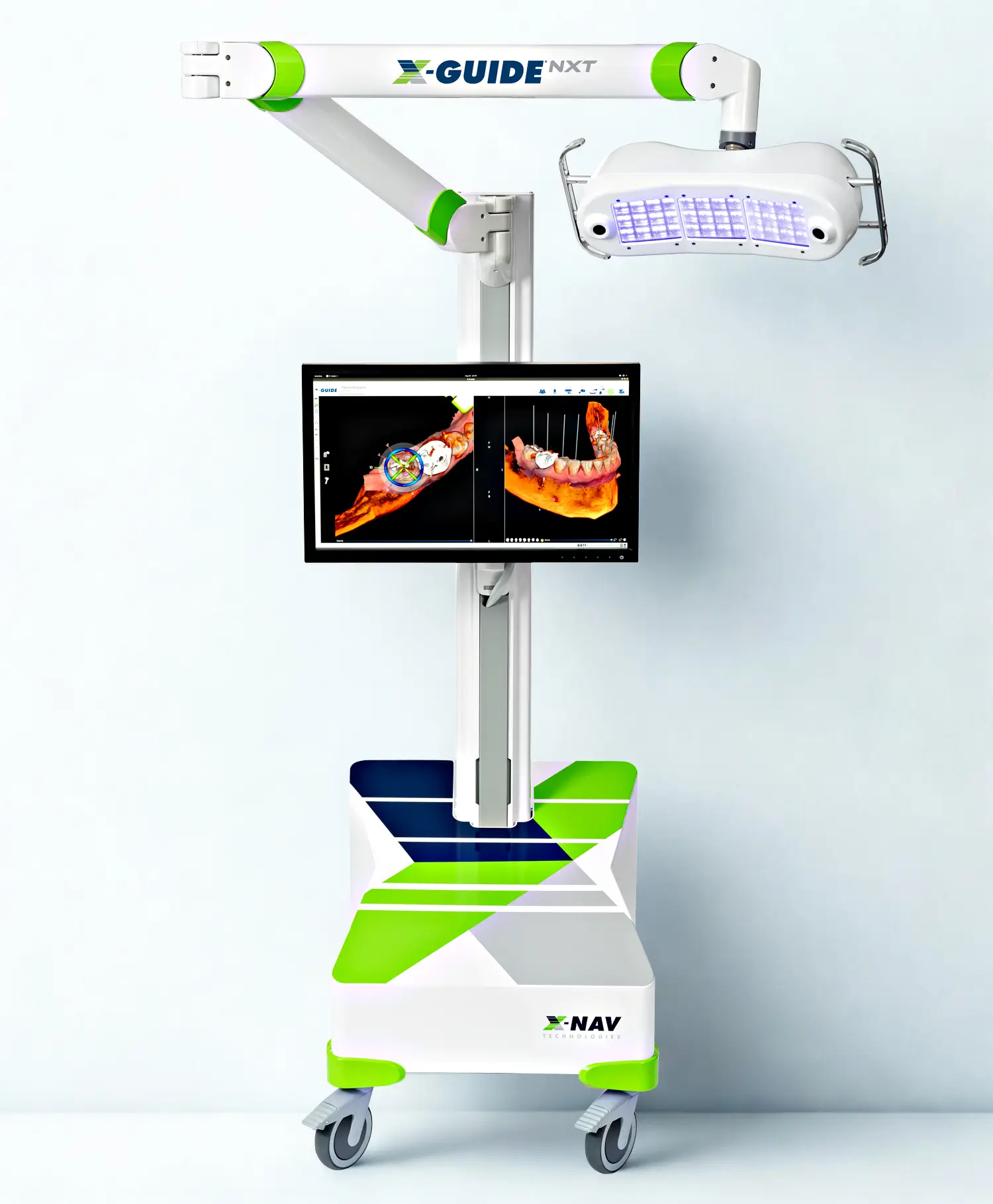 Công nghệ định vị X-Guide
