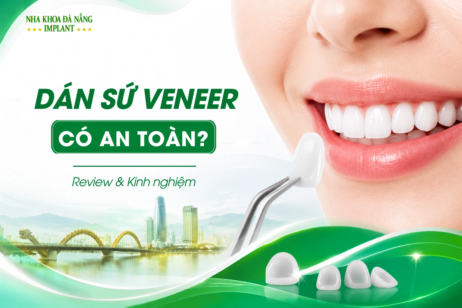Dán Sứ Veneer Có An Toàn Không? Review & Kinh Nghiệm Thực Tế