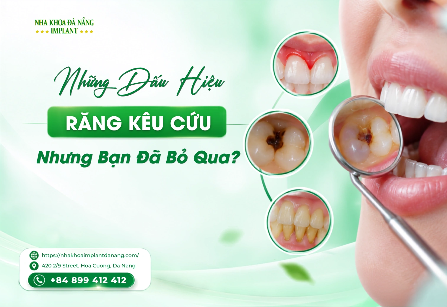8 Dấu Hiệu Răng Miệng Đang “Kêu Cứu” Thường Bị Bỏ Qua