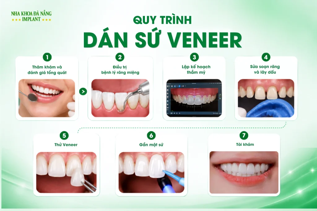 Quy trình dán sứ Veneer