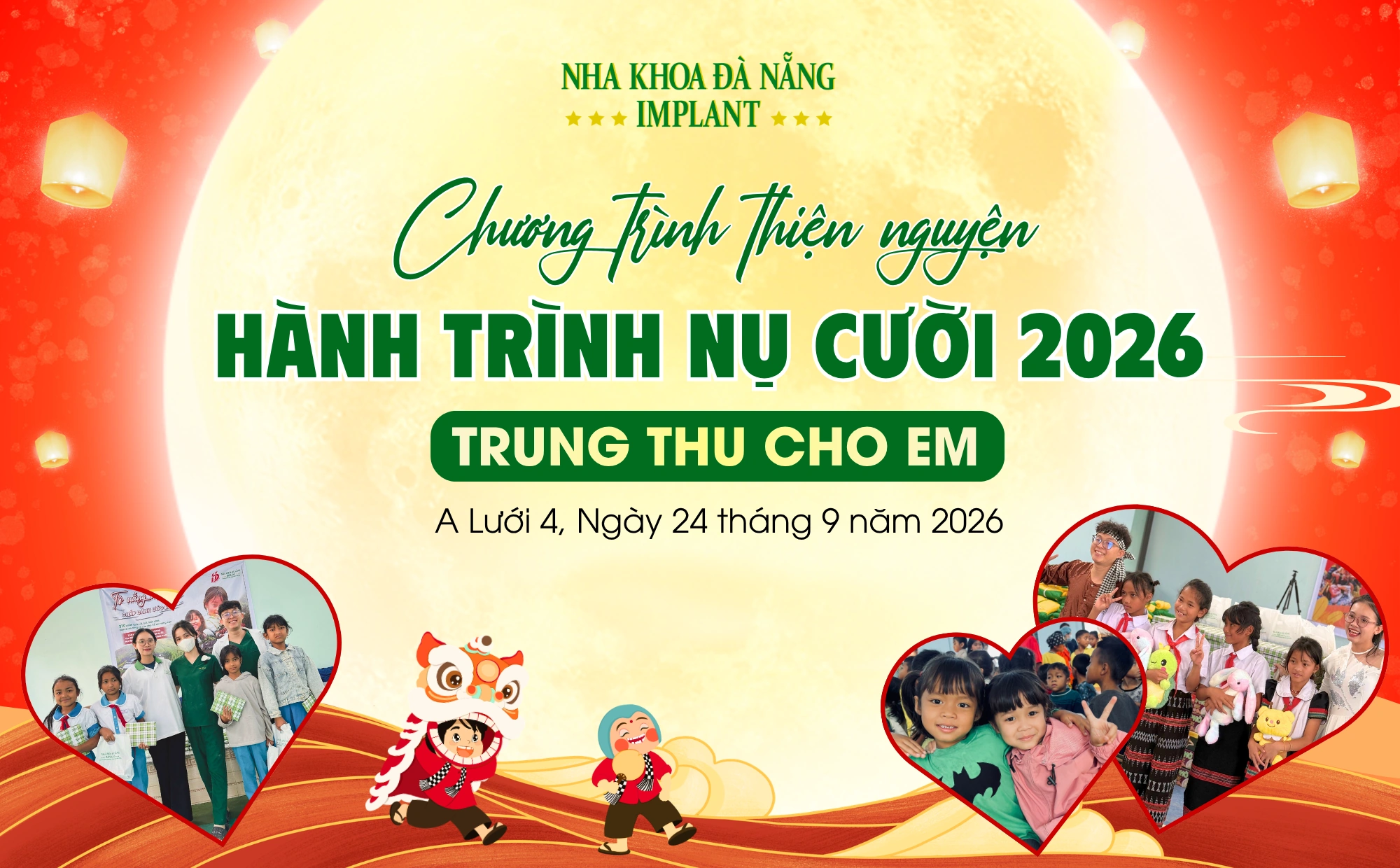 Chương Trình Thiện Nguyện “Hành Trình Nụ Cười 2026”: Nha Khoa Đà Nẵng Implant mang Trung Thu đến với Trường Tiểu học A Roàng