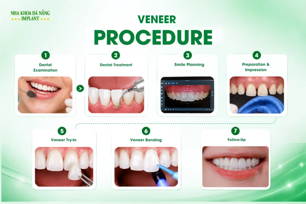 Are Dental Veneers Safe? Reviews & Real-Life Experiences 7 Dental Veneer Procedure