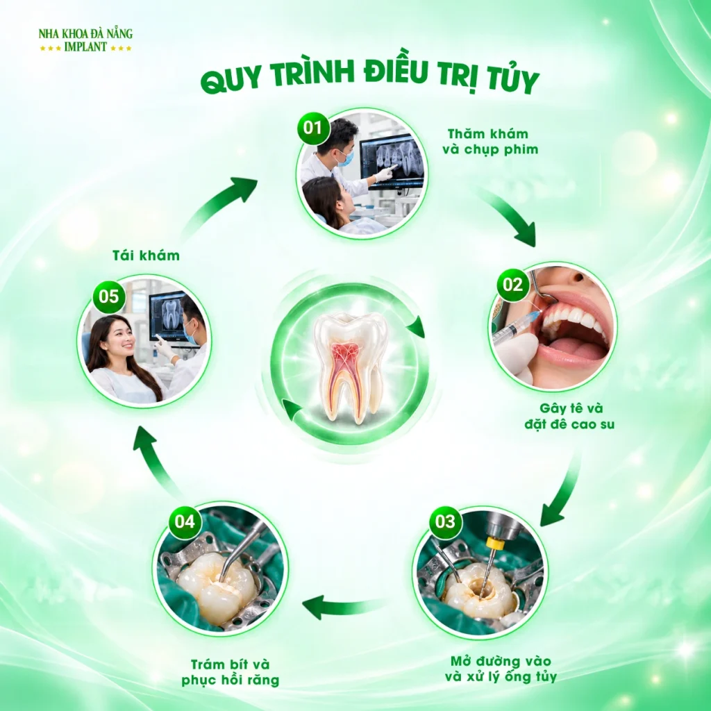 Quy trình điều trị tủy