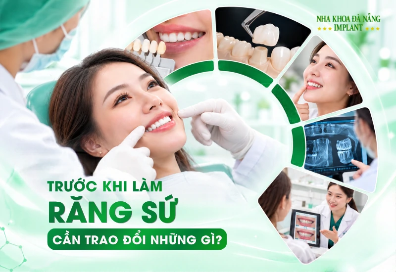 Trước Khi Làm Răng Sứ: Cần Trao Đổi Gì Để Có Kế Hoạch Phù Hợp Với Mình?