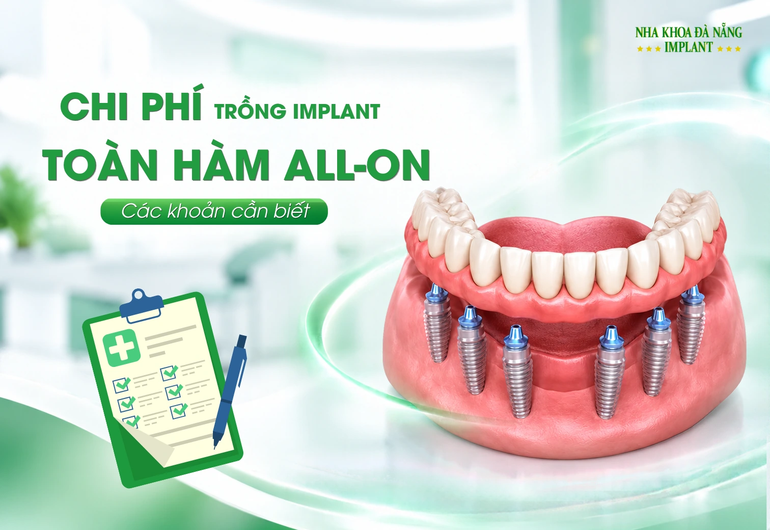 Chi Phí Trồng Implant Toàn Hàm All-on: Các Khoản Cần Biết 