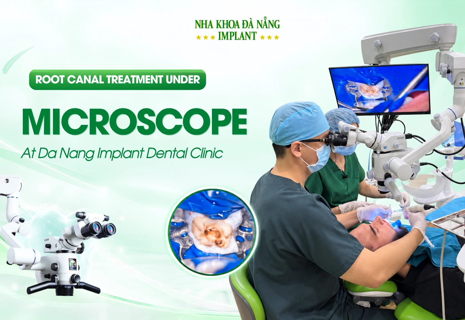 What Is Different About Microscope-Assisted Root Canal Treatment in Da Nang?